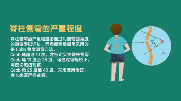 脊柱侧弯02.gif 脊柱侧弯02.gif